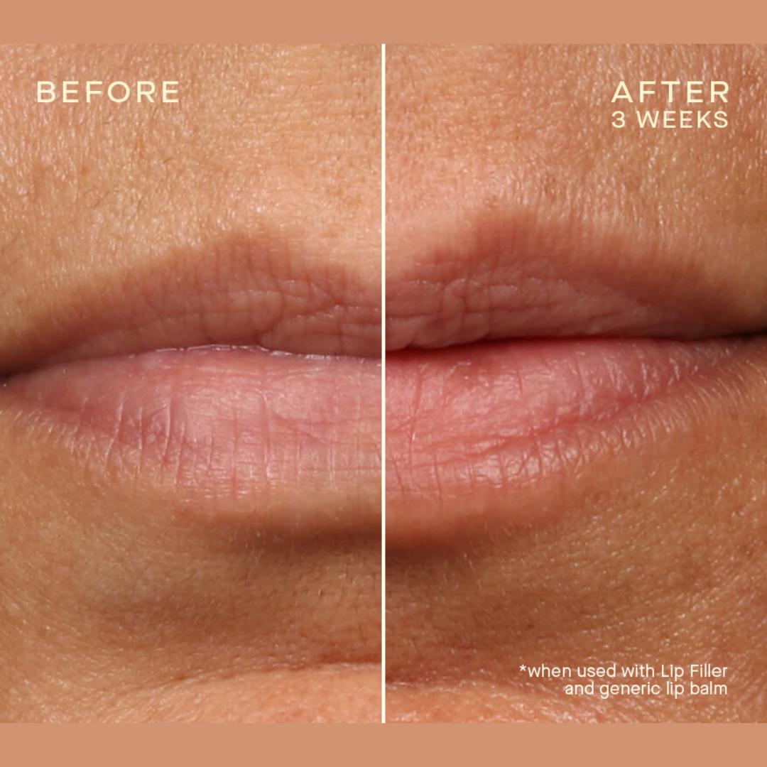 Ourself | Lip Filler Refill